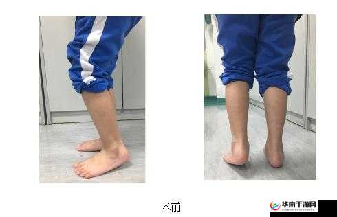 宝宝双腿交叉使劲用力：正常现象还是异常表现？