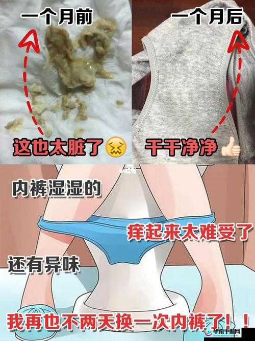 下边痒还一直湿漉漉：难以启齿的私密问题