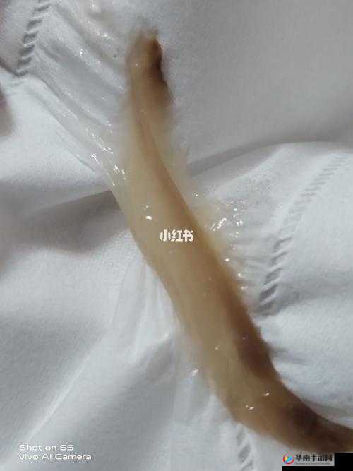 女生流出白白的东西怎么回事：探寻真相