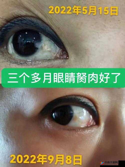 获得超级胬肉系统怎么办：获得超级胬肉系统后的应对策略