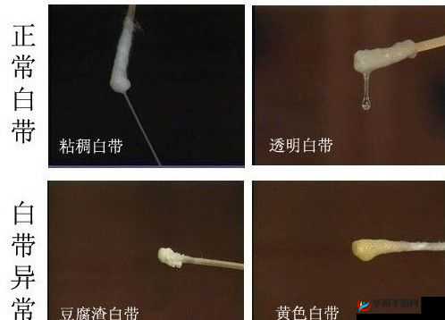 白色液体流出且睡不着咋回事