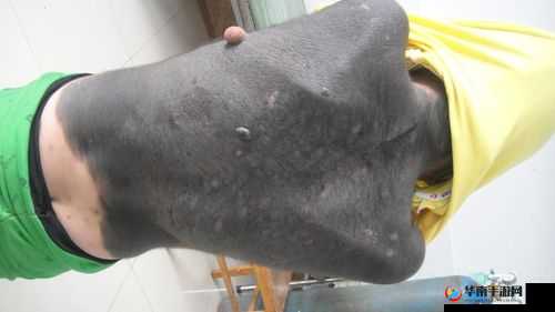 明日之后兽皮获取攻略：解析兽皮的作用及获取途径，快速获取海量兽皮技巧大解密