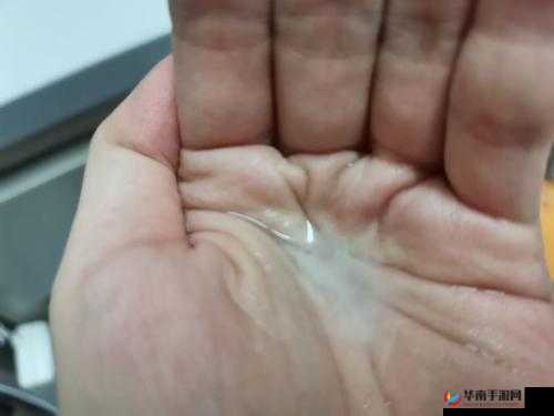 男生流出白色的粘稠物是什么：原因解析