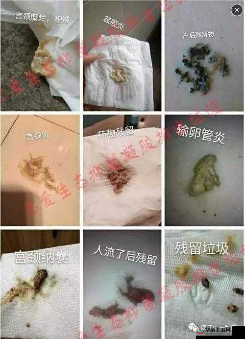 排阴毒：顶级村医的传奇医术