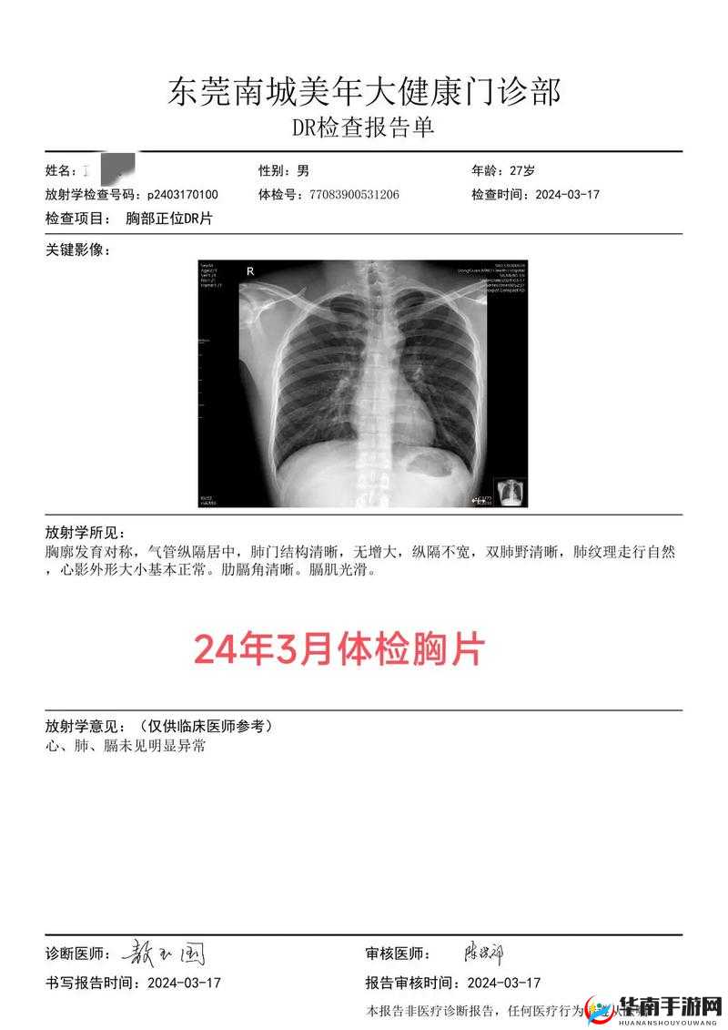 100%胸片曝光：深度解析其在医疗诊断中的关键作用