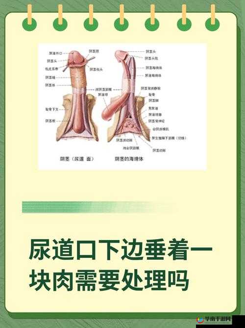 尿道口两边的肉肿了原因分析及相关症状探讨