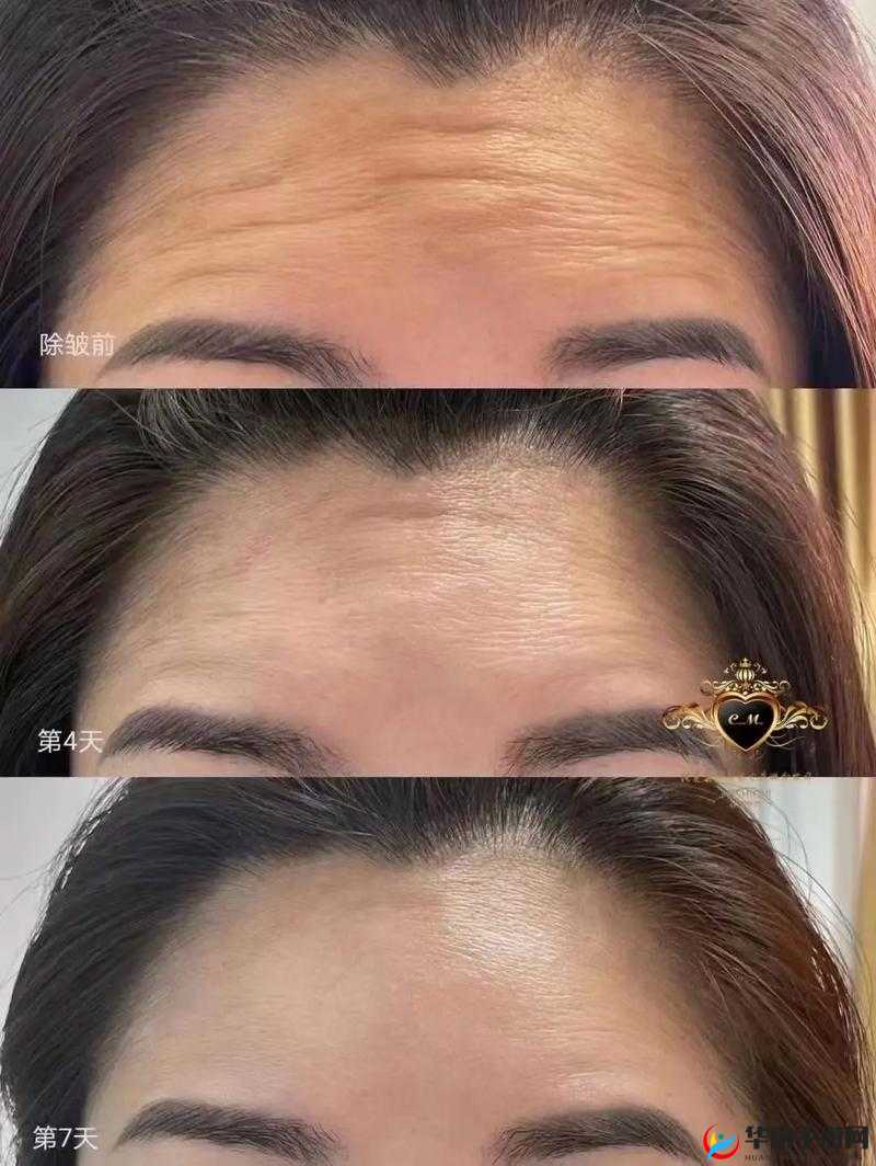 FREEZEFRAME 丰满老师的抗衰奇迹：探索肌肤年轻的奥秘之旅