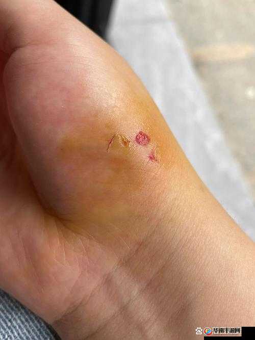 小白兔子被咬得通红，究竟发生了什么