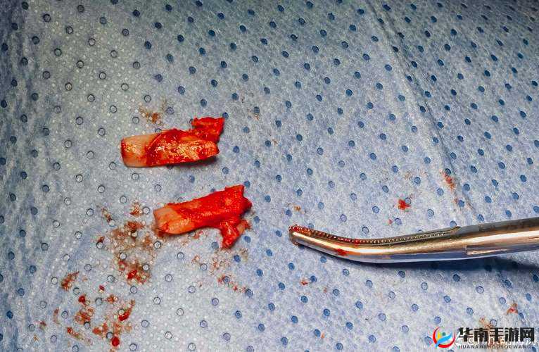 为什么不行？快拔出来不能这样做，会受伤的