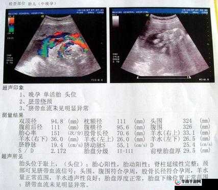 怀孕检查做彩超还是 B 超？哪种更适合？